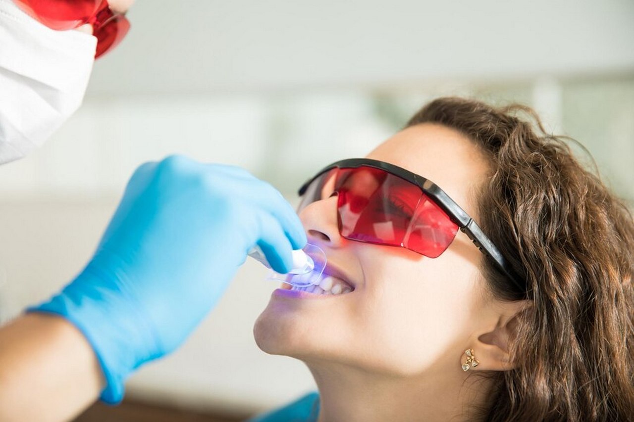 Jakie są popularne metody wybielania zębów?